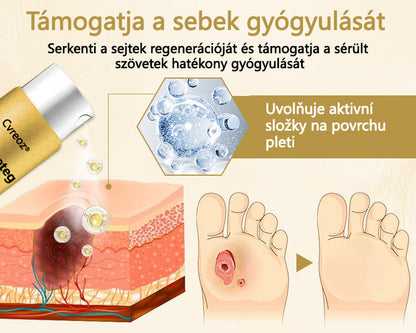 Cvreoz® méhméreg gyógyító spray a sebek gyógyulására és regenerálására a kezeken és a lábakon🩹