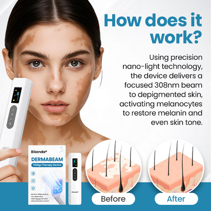 Bikenda® DermaBeam Vitiligo terápiás készülék