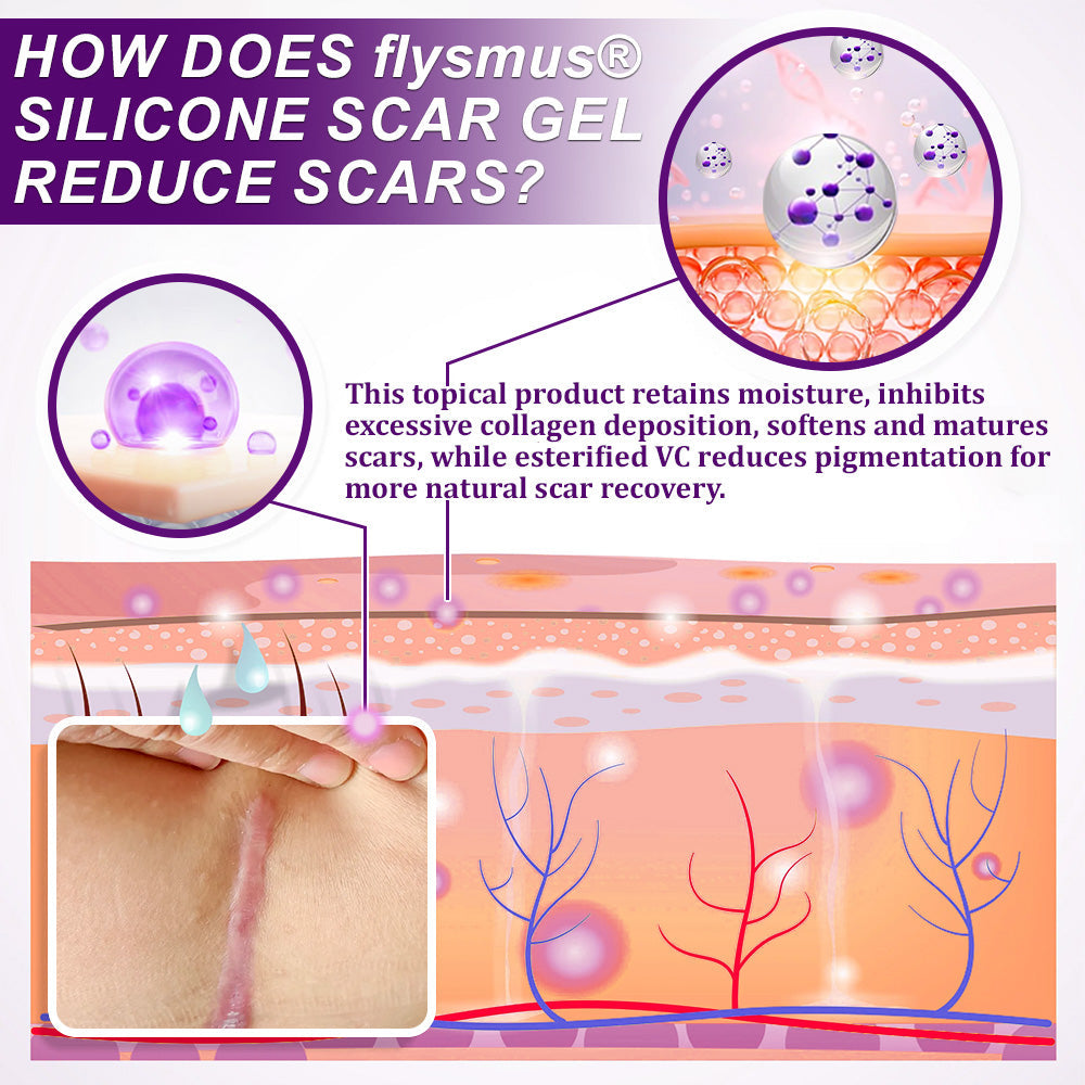 💙💙UKCA-TANÚSÍTVÁNYÚ ✅flysmus® cure ARC- ÉS TESTHEGEKRÉM GÉL – Klinikailag bizonyítottan lágyítja, simítja és halványítja a műtéti hegeket, aknés nyomokat, égési sérüléseket, keloidokat és traumás hegeket.