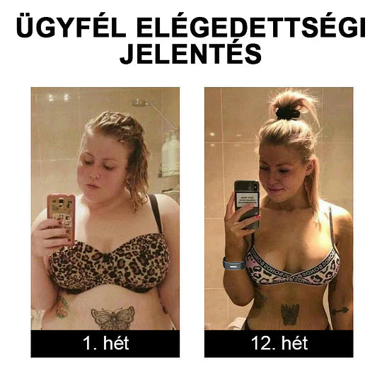 🥑 𝐉𝐎𝐒𝐅𝑰𝐓™ Ultrahangos csuklópántok a zsír eltávolítására és méregtelenítésére