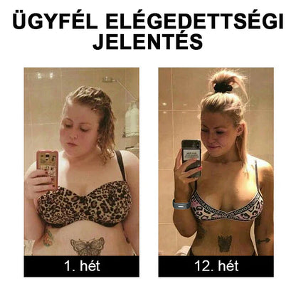 🥑 𝐉𝐎𝐒𝐅𝑰𝐓™ Ultrahangos csuklópántok a zsír eltávolítására és méregtelenítésére