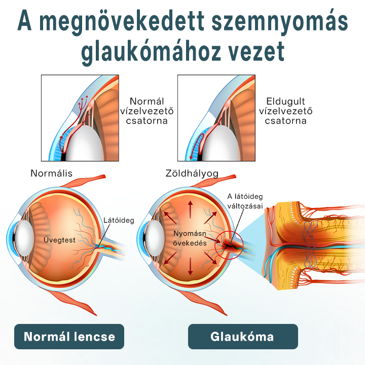 Timilk® OptiFusion Nano szemcsepp szérum🌟