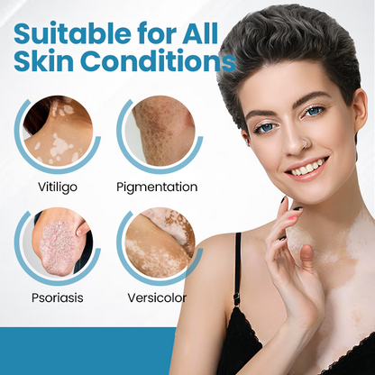 Bikenda® DermaBeam Vitiligo terápiás készülék