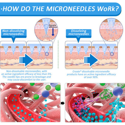 CROAIE® 🌱Nano Microneedle Patch with SMGT-GLP-1 & Matrixyl 3000 – Slimming, Skin Tightening, Blood Sugar Support, No Injection, 7-Day Result